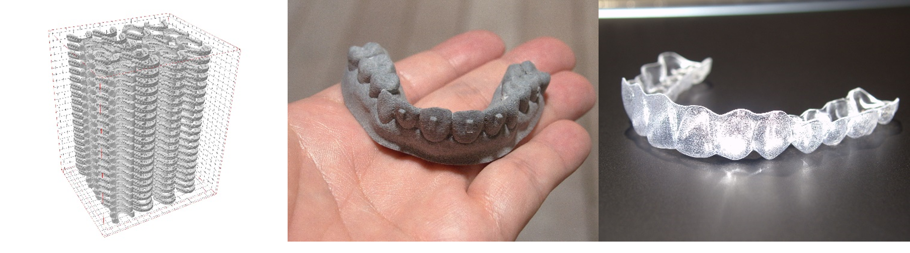 3Dプリンターを活用した、 歯科矯正用マウスピースの製造、配送